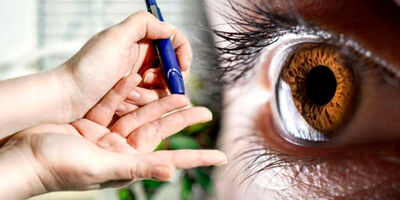 کدام عارضه‌ چشم را هدف می‌گیرد؟