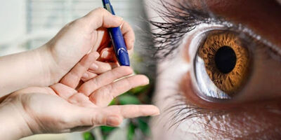 کدام عارضه‌ چشم را هدف می‌گیرد؟