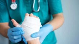 چند اشتباه شایع در مواجهه با سوختگی پوست + راهنمای رسیدگی فوری به سوختگی