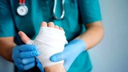 چند اشتباه شایع در مواجهه با سوختگی پوست + راهنمای رسیدگی فوری به سوختگی