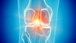 تاثیر باورنکردنی سماگلوتاید بر آرتروز

