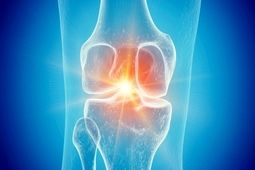 تاثیر باورنکردنی سماگلوتاید بر آرتروز
