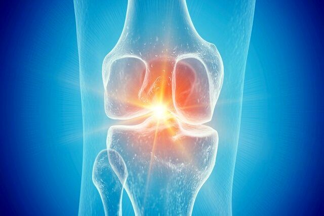 تاثیر باورنکردنی سماگلوتاید بر آرتروز
