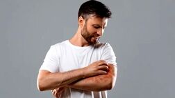 کهیر عصبی چیست ؟ علائم و راهکارهایی برای درمان کهیر عصبی