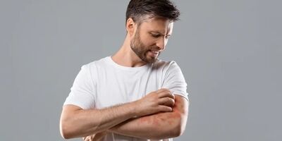 کهیر عصبی چیست ؟ علائم و راهکارهایی برای درمان کهیر عصبی