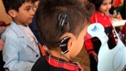 تامین بیش از هزار پروتز برای کودکان ناشنوا