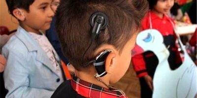 تامین بیش از هزار پروتز برای کودکان ناشنوا