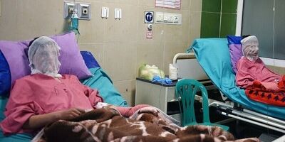 ۳۰ درصد سوختگی‌ها در کشور به کودکان اختصاص دارد