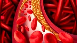 چند توصیه برای کاهش چربی خون
