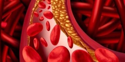 چند توصیه برای کاهش چربی خون
