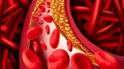 چند توصیه برای کاهش چربی خون
