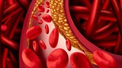 چند توصیه برای کاهش چربی خون
