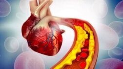 علائم نارسایی قلبی کدامند؟
