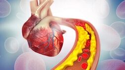 علائم نارسایی قلبی کدامند؟
