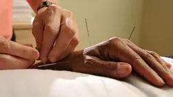 کاهش خطر سکته مغزی در مبتلایان به آرتریت روماتوئید با طب سوزنی
