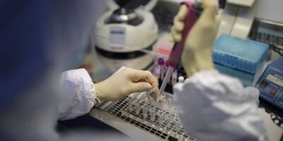 غربالگری سرطان روده یک میلیون نفر با کیت نانویی
