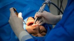 سهم اندک بیمه ها در پرداخت های دندانی شهروندان