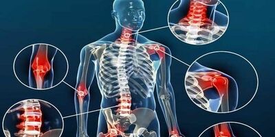 مواد غذایی که علائم آرتروز را تشدید می‌کنند