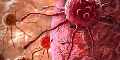 آرایشگرهای زنانه با ریسک بالای سرطان تخمدان روبرو هستند