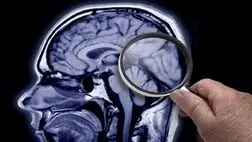 نشانگرهای خونی بیماری آلزایمر را از ۱۰ سال قبل نشان می دهند