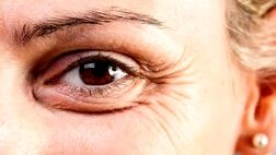 آیا می‌دانید چرا با بالا رفتن سن پوستمان چروک می‌شود؟
