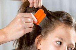 راهکار خلاصی کودک از شپش را بشناسید
