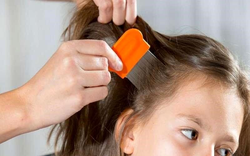 راهکار خلاصی کودک از شپش را بشناسید