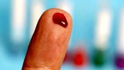 ۹۰ درصد ایرانیان گروه خونی مثبت دارند
