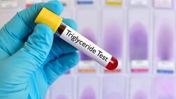 مهم‌ترین راهکار کنترل چربی خون را بشناسید 