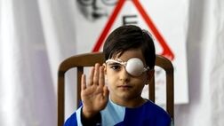 19 هزار کودک مبتلا به بیماری تنبلی چشم شناسایی شدند