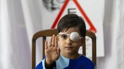 19 هزار کودک مبتلا به بیماری تنبلی چشم شناسایی شدند