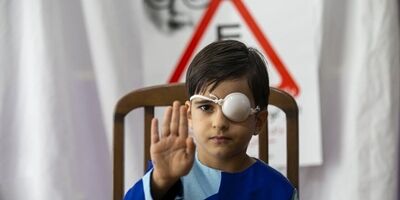 19 هزار کودک مبتلا به بیماری تنبلی چشم شناسایی شدند
