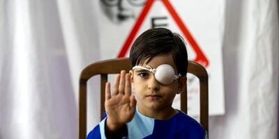 19 هزار کودک مبتلا به بیماری تنبلی چشم شناسایی شدند