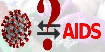 خطر ابتلا به کووید ۱۹ شدید در بیماران HIV بیشتر است