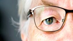 پیرچشمی چیست و چه زمانی بروز می‌کند؟
