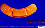 بیمه درمان انفرادی را از بیمه تعاون بخواهید