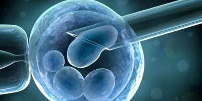 احتمال درمان بیماران HIV با سلول های بنیادی