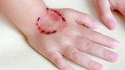 افزایش آمار گازگرفتگی توسط حیوانات خانگی