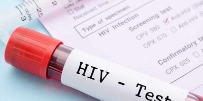 داروهای HIV خطر انتقال ایدز را تقریباً به صفر می رسانند