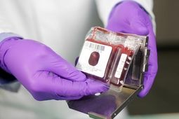 ذخیره‌سازی خون بند ناف، بیمه سلامتی برای آینده
