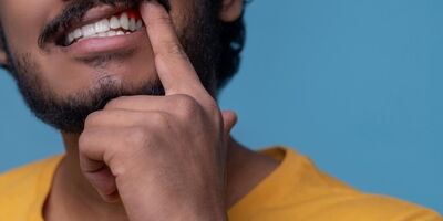تغییر رنگ لثه نشانه چیست ؟