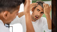 با این روش‌ها از سفید شدن زودرس مو جلوگیری کنید