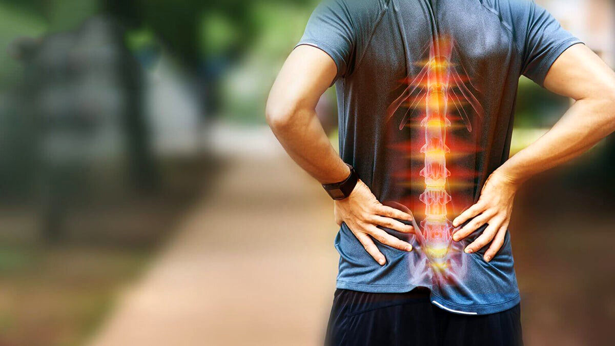 این علائم نشانه ابتلا به دیسک کمر است