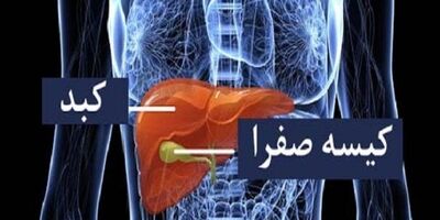 علائم سرطان کیسه صفرا و مجرای صفراوی را بشناسید