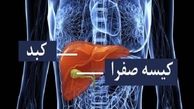 علائم سرطان کیسه صفرا و مجرای صفراوی را بشناسید