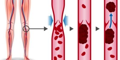 چند توصیه کاربردی برای افراد مبتلا به تنگی نفس
