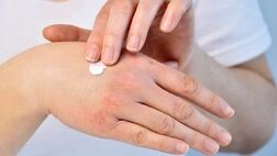 چند توصیه برای مقابله با خشکی پوست در زمستان
