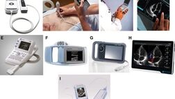 کمک هوش مصنوعی به تشخیص سریع نارسایی قلبی