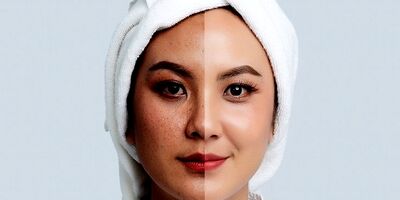 علت تیرگی پوست صورت و راه های درمان آن
