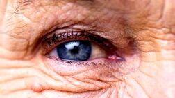 داروهای کلسترول و دیابت ریسک بیماری چشمی را کاهش می دهند